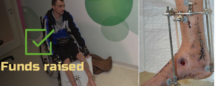 Vitaliy G, 37. Treatment is in progress