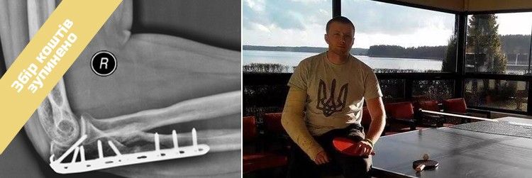 Сергій Л., 24 роки. Збір коштів зупинено