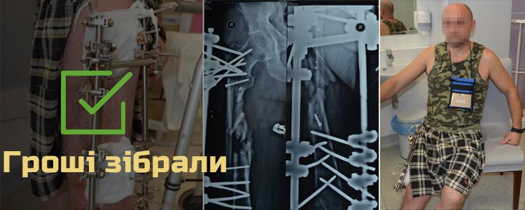 Олег, 47 років. Лікування завершено, триває реабілітація