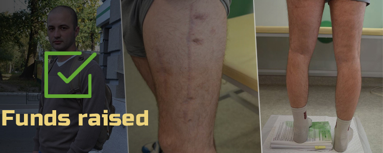 Dmytro, 25. Treatment is in progress