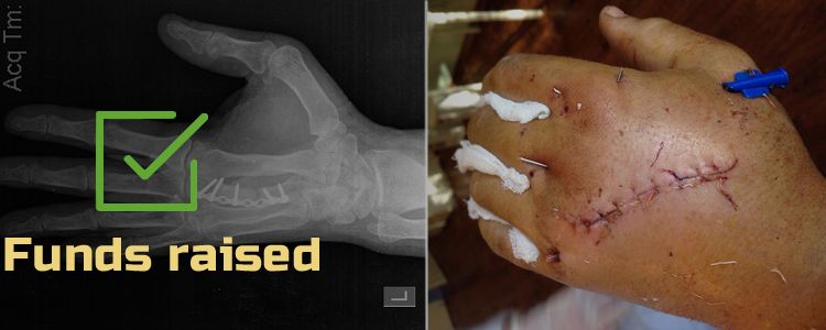 Andriy T, 43. Treatment is in progress