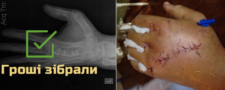 Андрій Т., 43 роки. Лікування триває