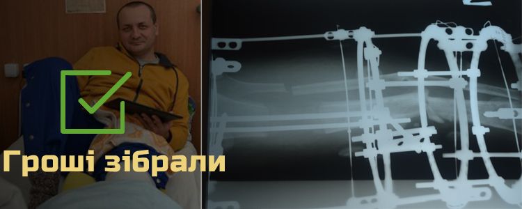 Андрій С., 41 рік. Лікування триває