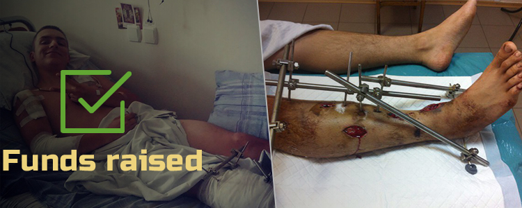 Ihor, 19. Treatment completed. Rehabilitation is in progress