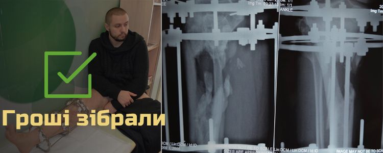 Олександр Р., 28 років. Лікування триває