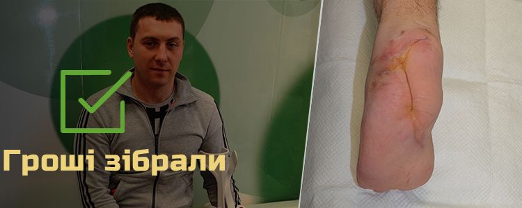 Володимир Ф., 36 років. Триває реабілітація