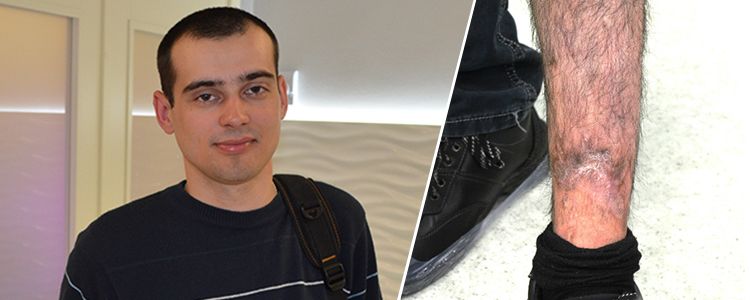 Богдан З., 22 роки. Вартість лікування 312 937 грн
