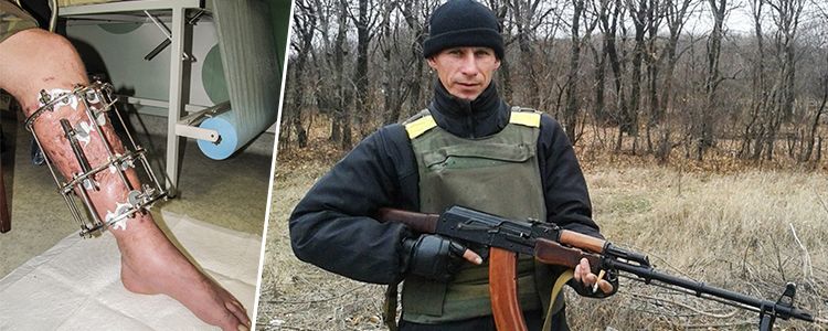 Володимир С., 37 років. Вартість лікування 611 899 грн