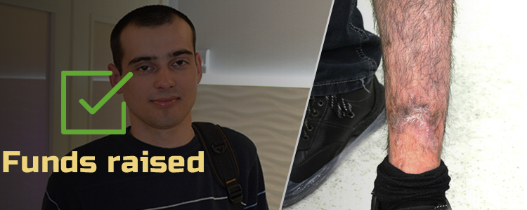 Bohdan Z, 22. Treatment in progress