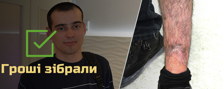 Богдан З., 22 роки. Лікування розпочато