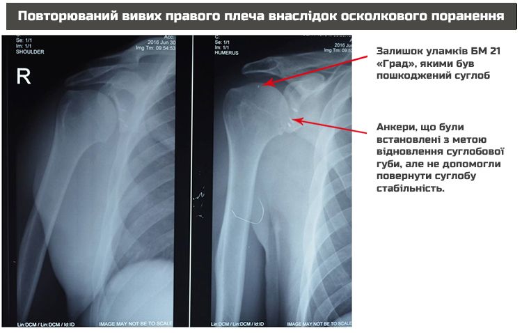 X-Ray Oleg Dav
