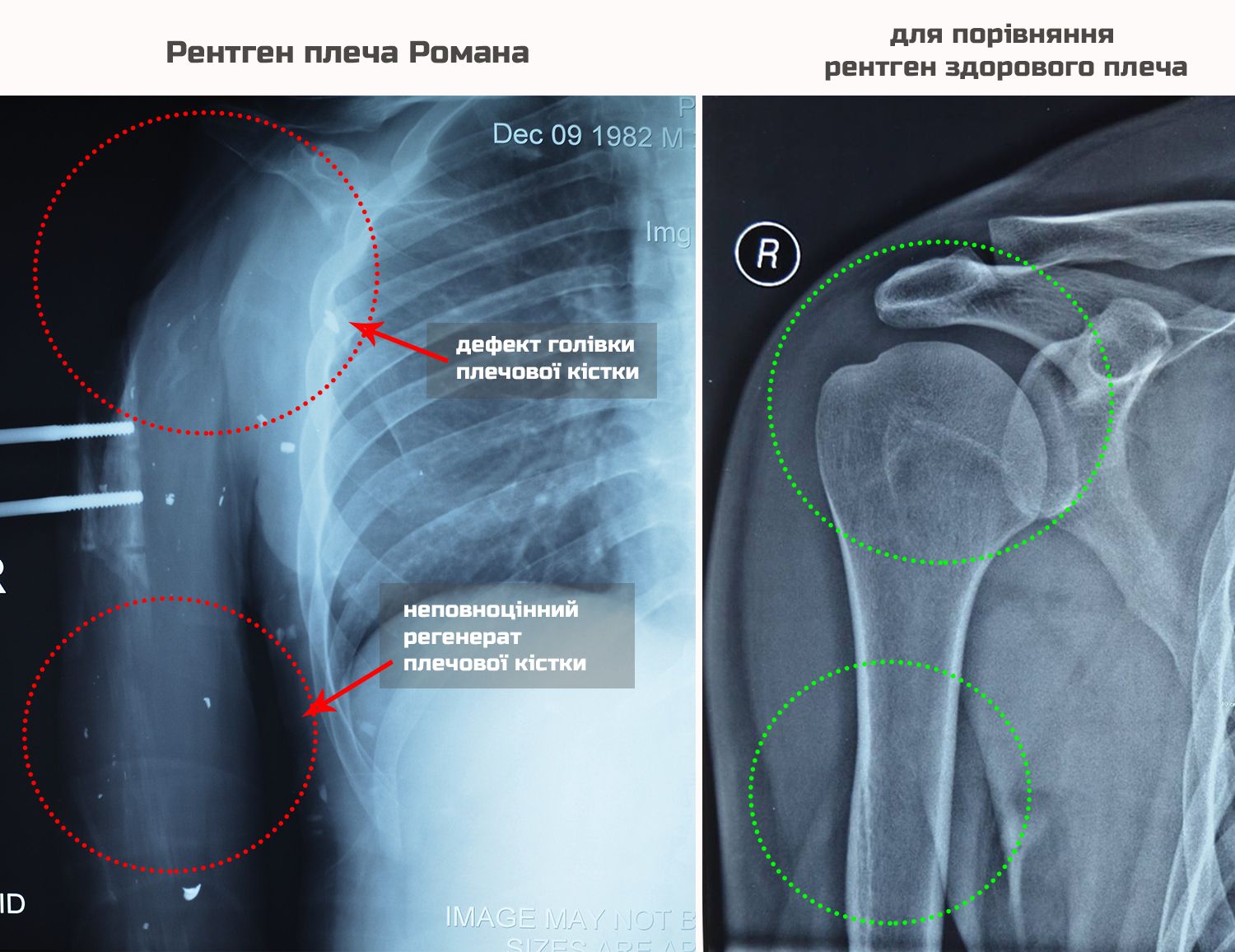 X-ray comparison