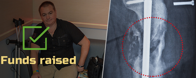 Serhiy K, 40. The treatment is in progress