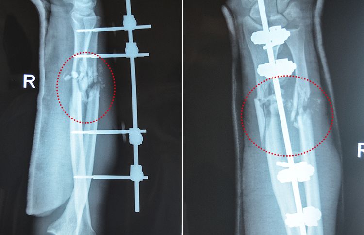 x-ray-forearm