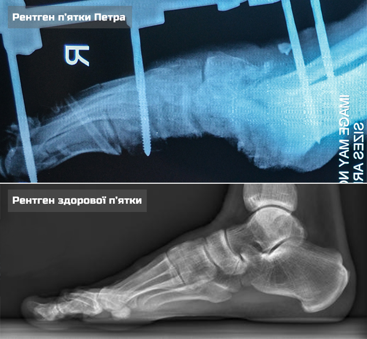 Petro O-X-ray comperison