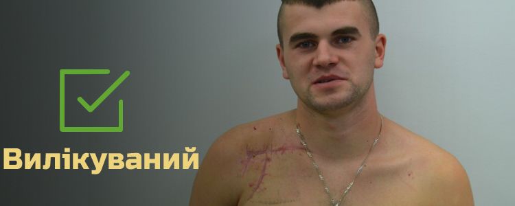 Михайло, 21 рік. Лікування успішно завершено