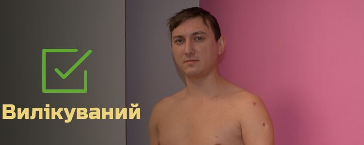 Євген, 25 років. Лікування успішно завершено