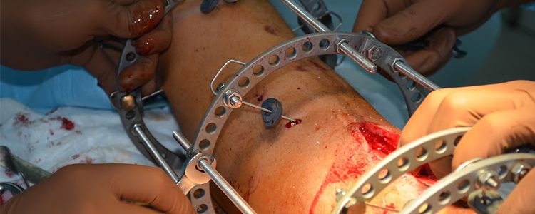 The main stage of Andriy’s treatment