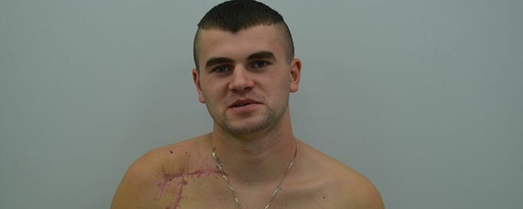 Results of Mykhailo’s treatment