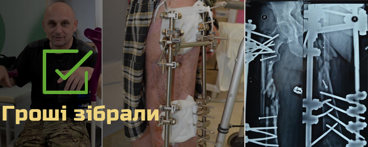 Олег, 47 років. Розпочався додатковий етап лікування