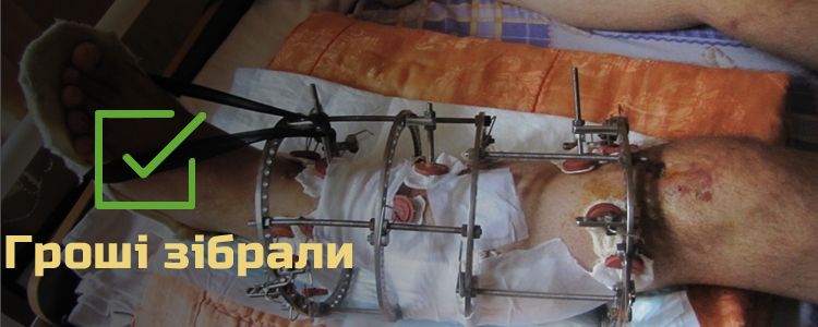 Віктор Д., 34 роки. Лікування завершено