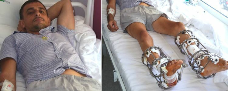 ‘Cyborg’ Vitaliy undergoes major surgery