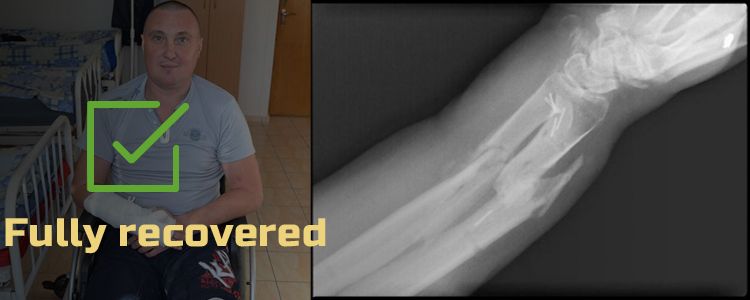 Serhiy D, 40. Treatment completed, rehabilitation is in progress