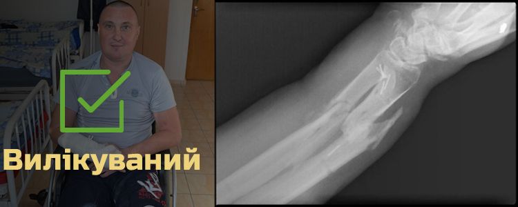 Сергій Д., 40 років. Лікування завершено