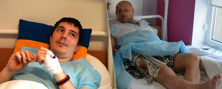 Oleksiy undergoes first operation and Oleh has apparatus removed
