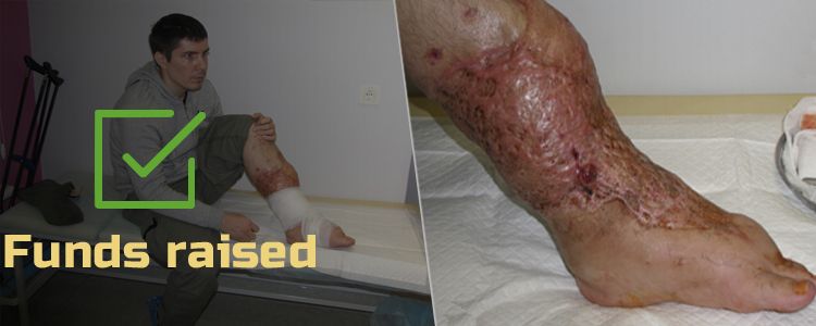 Oleksiy B, 31. Treatment is in progress