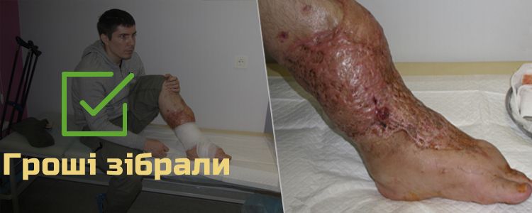 Олексій Б., 31 рік. Лікування триває