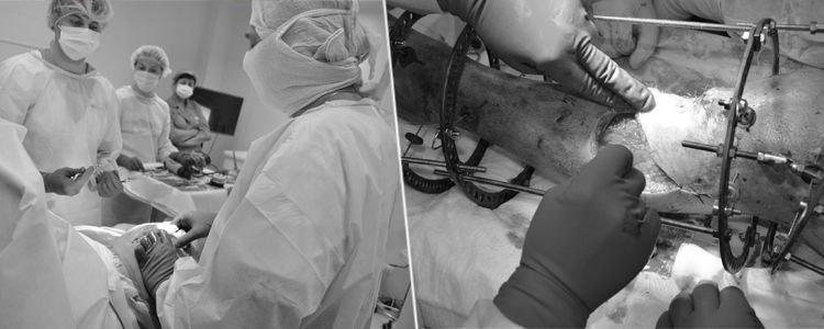 Знімок Андрія, операції на стопі Олександра та демонтаж апарату Віктора