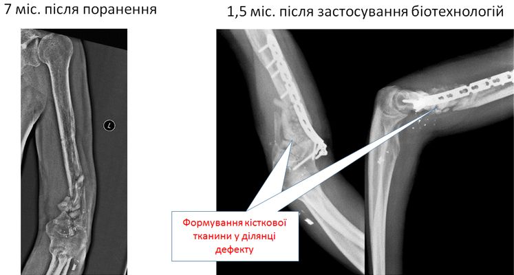 x-ray Роман