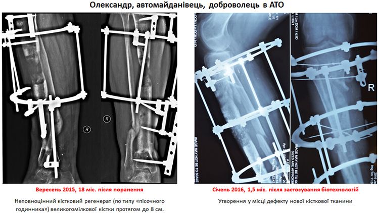 x-ray Olexandr 31