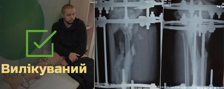 Олександр Р., 28 років. Додатковий етап лікування через травму бійця