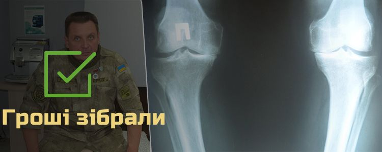 Юрій Р., 52 роки. Лікування триває