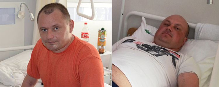 Oleksiy and Volodymyr enter first stage of treatment