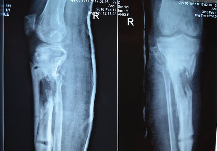 X-Ray-Oleksandr-inside