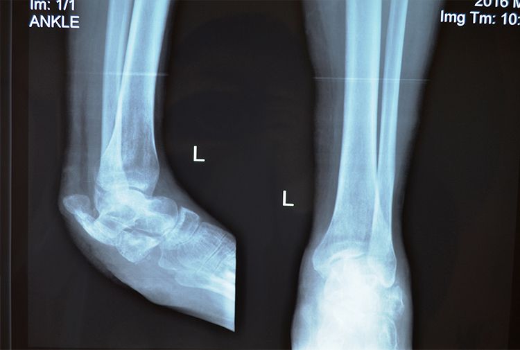 X-Ray Volodymyr