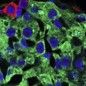 Scientists make breakthrough in treatment of diabetes with stem cells from adipose tissue