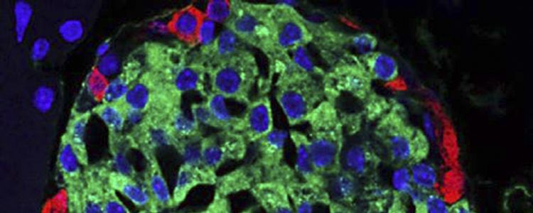 Scientists make breakthrough in treatment of diabetes with stem cells from adipose tissue