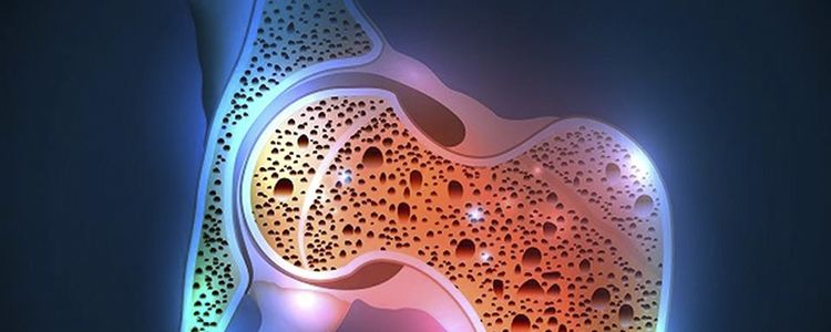 Osteoporosis cured by injecting stem cells