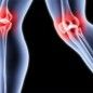 Flow of interstitial fluid can help identify the occurrence of osteoarthritis