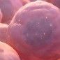 Antibiotics can prevent transplant donor stem cells