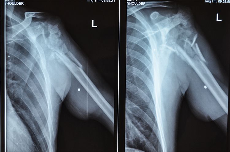 Inside X-Ray Oleksandr 37