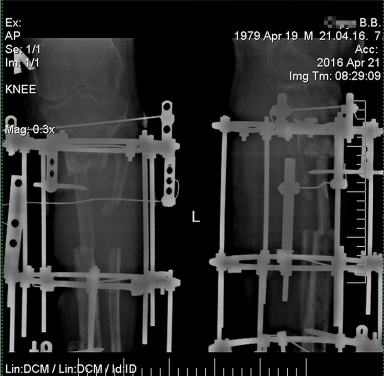 X-Ray-Volodymyr Str