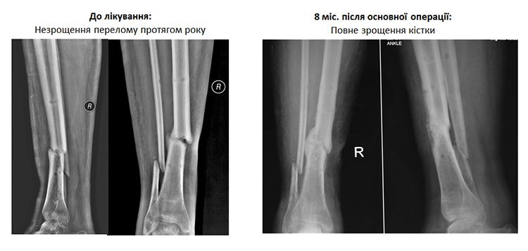 Yura-x-ray