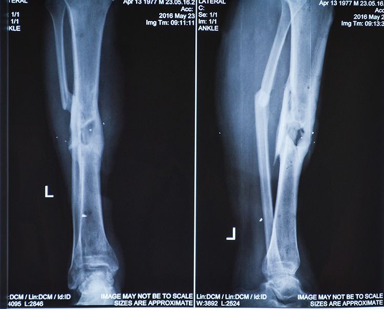 Oleksand x-ray 1