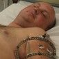 Restoring shoulder of wounded soldier using biotechnology