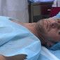 Doctors start battle to save Oleksandr’s arm